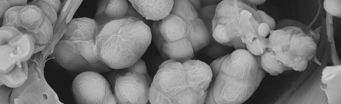 ATeN Center vince il contest Alfatest di microscopia elettronica SEM
